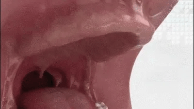 Yagoo™-Custom-Fit Full Functional Dentures image Yagoo™-Custom-Fit Full Functional Dentures